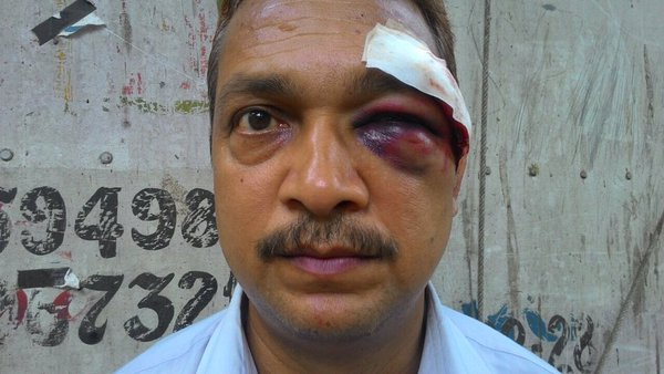 On-duty traffic constable assaulted by drunk men at Shivaji Park