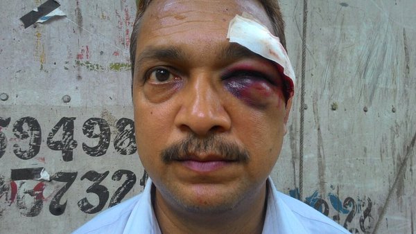 Youths assault police constable in Shivaji Park, get arrested within hours